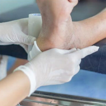 Diabetics Foot Care treatment in the Florence County, SC: Florence (Quinby, Effingham, Peniel Crossroads, Sardis, Timmonsville, Winona, Coward) and Darlington County, SC: Darlington, Lamar, Floyd areas