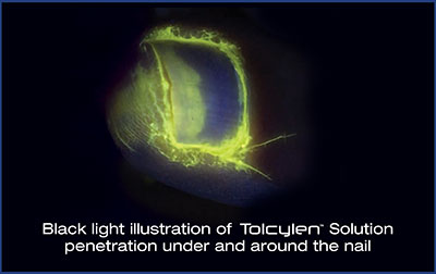 Black light illustration of Tolcylen solution treatment in the Florence County, SC: Florence (Quinby, Effingham, Peniel Crossroads, Sardis, Timmonsville, Winona, Coward) and Darlington County, SC: Darlington, Lamar, Floyd areas